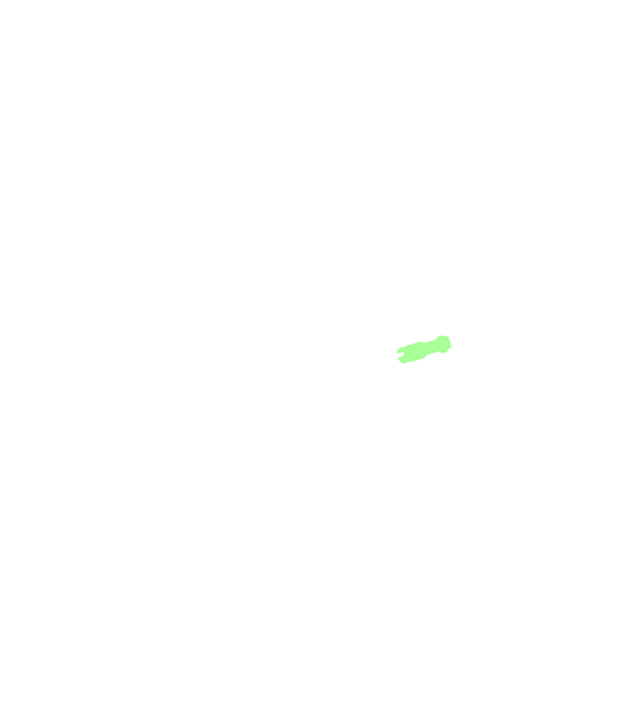 Overlay 3